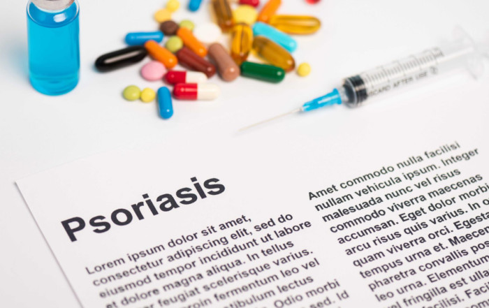 плакатен псориазис лечение