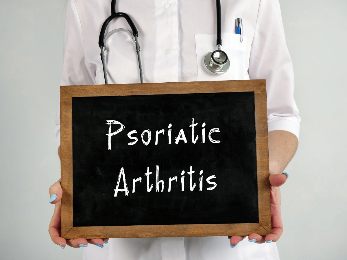 какво е псориатичен артрит