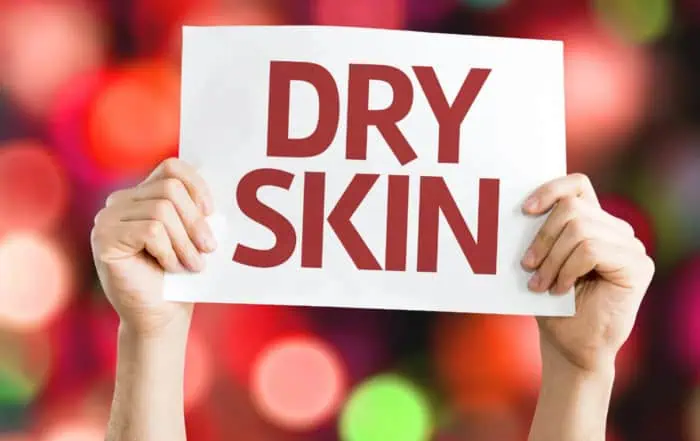 псориазис в студените месеци