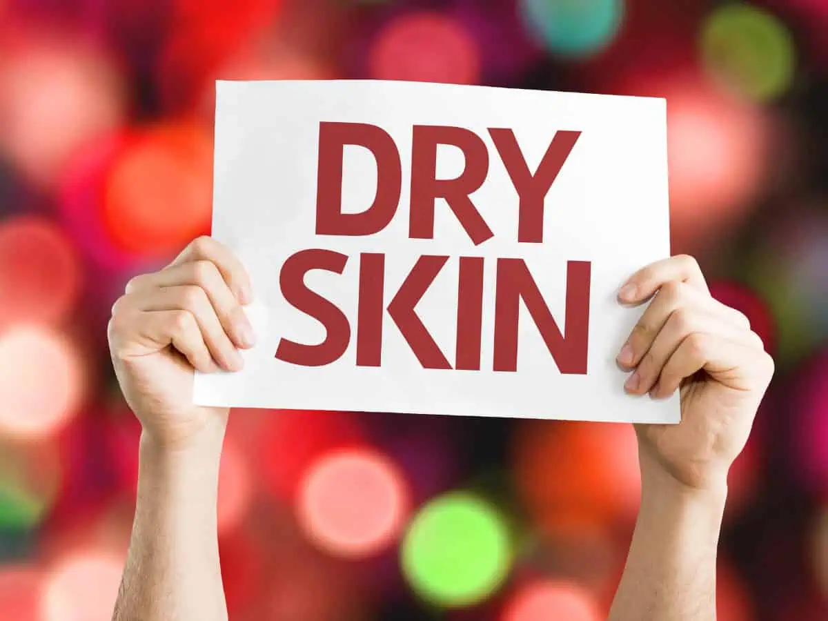 псориазис в студените месеци