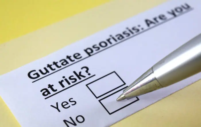 Гутатен псориазис
