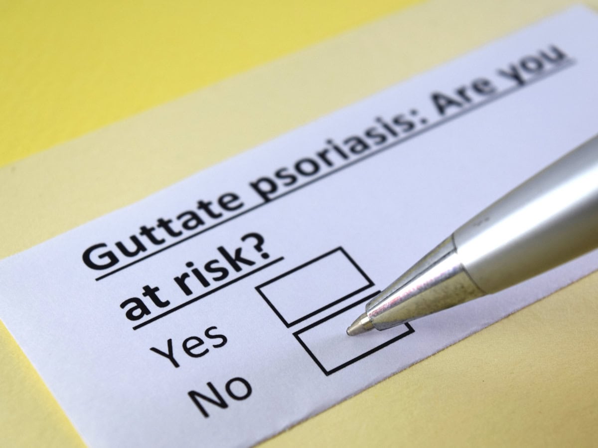 Гутатен псориазис