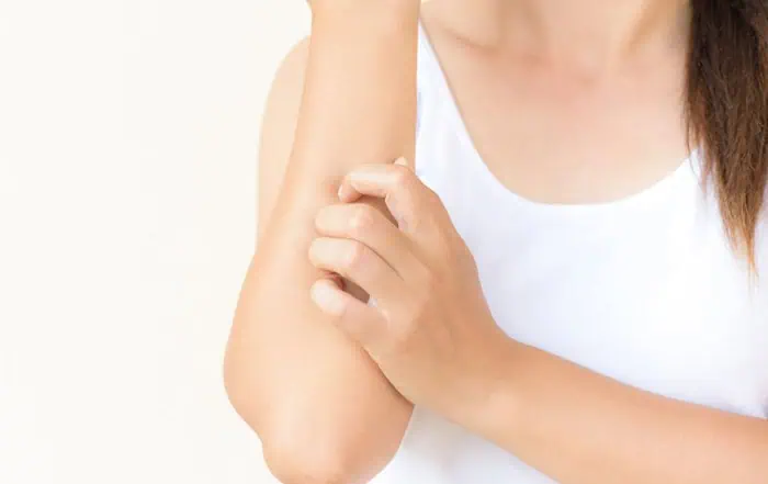 Пустулозен псориазис