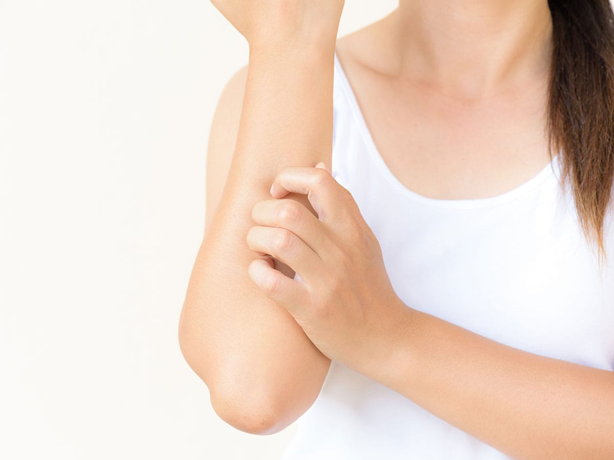 Пустулозен псориазис