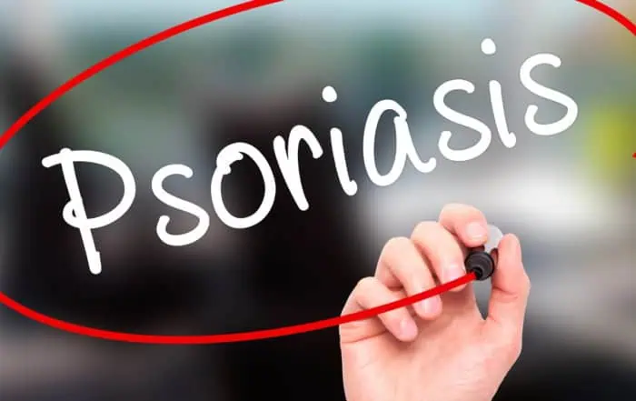 начални симптоми на псориазис