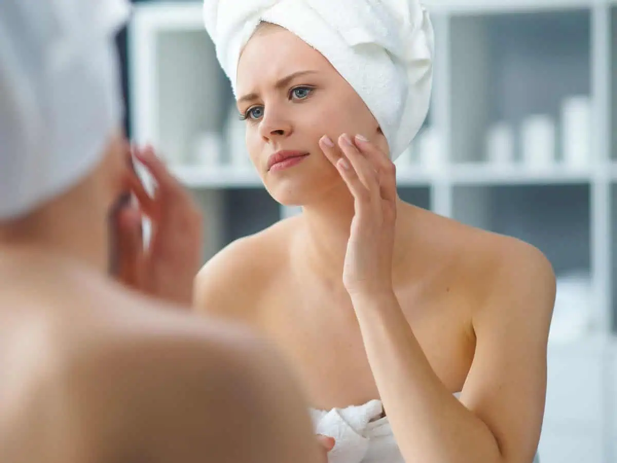 Как започва псориазисът